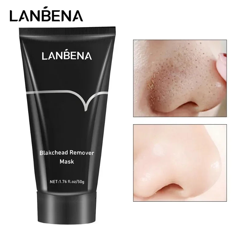 Máscara de Limpeza Profunda de Poros, Diminui a Pele Áspera, Tratamento Para Acne, Clareamento da Pele