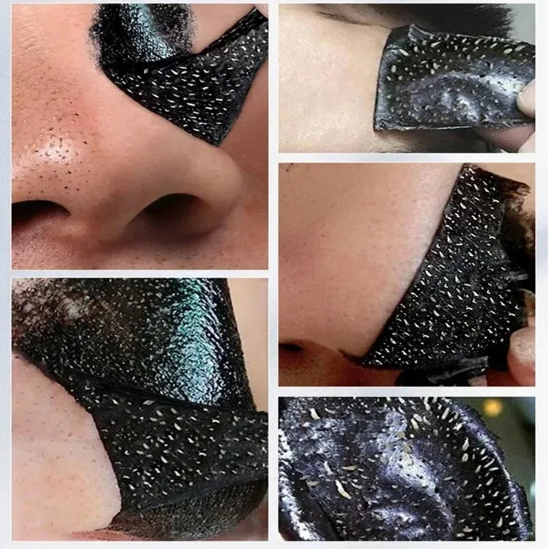 Máscara de Limpeza Profunda de Poros, Diminui a Pele Áspera, Tratamento Para Acne, Clareamento da Pele